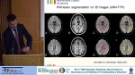 How Education and Public Involvement in Human Neuroimaging Could Help Patients